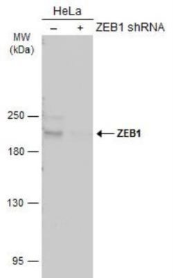 ZEB1 Antibody, Novus Biologicals 0.1mL; Unlabeled:Antibodies, Polyclonal