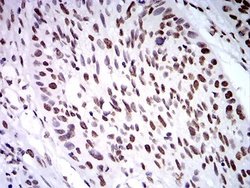 ZFP91 Antibody (7G11H2) - BSA Free, Novus Biologicals 0.1 ml; Unconjugated:Antibodies,