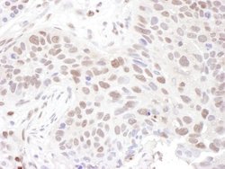 ZNF462 Antibody, Novus Biologicals 0.1mg; Unlabeled:Antibodies, Polyclonal