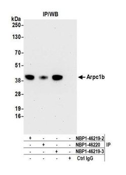 actin-related protein 2/3 complex subunit 1B Antibody, Novus Biologicals
