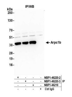actin-related protein 2/3 complex subunit 1B Antibody, Novus Biologicals 0.1 mL | Buy Online | Novus Biologicals | Fisher Scientific