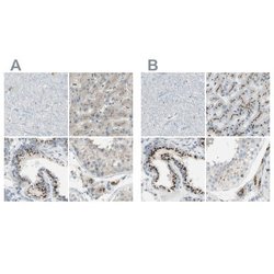 beta-1,4-Galactosyltransferase 1/B4GalT1 Antibody, Novus Biologicals:Antibodies:Primary
