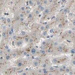 beta-1,4-Galactosyltransferase 1/B4GalT1 Antibody, Novus Biologicals:Antibodies:Primary