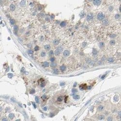 beta-1,4-Galactosyltransferase 1/B4GalT1 Antibody, Novus Biologicals:Antibodies:Primary