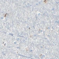 beta-1,4-Galactosyltransferase 1/B4GalT1 Antibody, Novus Biologicals:Antibodies:Primary