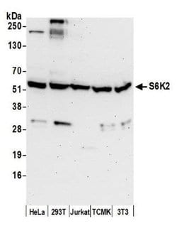 p70 S6 Kinase beta/S6K2 Antibody, Novus Biologicals 0.1mL; Unlabeled:Antibodies,