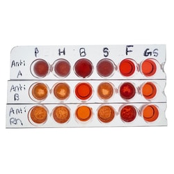 EDVOTEK&trade;&nbsp;The Science Behind Finding a Perfect Match : Blood Typing for Stem Cell Transplants