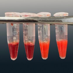 EDVOTEK The Science Behind Finding a Perfect Match : Blood Typing for Stem Cell Transplants 10 Lab Groups | Buy Online | EDVOTEK&trade; | Fisher Scientific