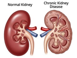 EDVOTEK&trade;&nbsp;Tracking Health Through Urinalysis: A Case-Based Clinical Simulation