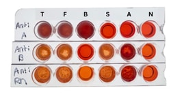 EDVOTEK&trade;&nbsp;Matchmakers in Medicine: Kidney Transplant Compatibility