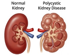 EDVOTEK Matchmakers in Medicine: Kidney Transplant Compatibility 10 Lab Groups | Buy Online | EDVOTEK&trade; | Fisher Scientific