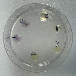 EDVOTEK&trade;&nbsp;Immune Clues : Diagnosing Allergic Reactions