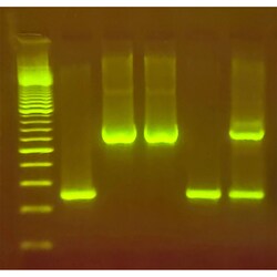 EDVOTEK ChickCheck: The Genetics Behind Blue Chicken Eggs 25 Students (5 Groups) | Buy Online | EDVOTEK&trade; | Fisher Scientific