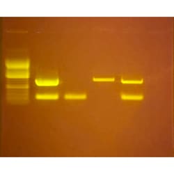 EDVOTEK&trade;&nbsp;Silent Signals : Tracking Disease Through PCR Wastewater Testing