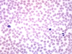 Eisco™ Prepared Microscope Slide - Human Blood Smear, Wright's Stain
