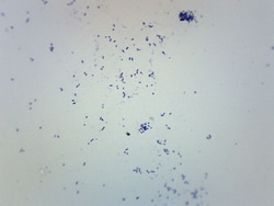 Eisco Streptococcus Pneumoniae, Gram Positive Steptpcpccus Pneumoniae:Education