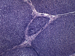 Eisco™ Liver Section (Mammal)