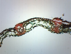 Eisco™ Puccinia Graminis Uredina Section