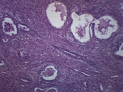 Eisco™ Prostate Section (Human), H&E Stain