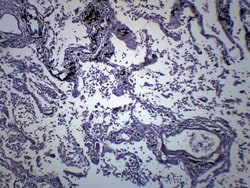 Eisco™ Respiratory System - Pneumonia (Human)