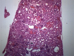 Eisco™ Frog Kidney Section, H&E Stain
