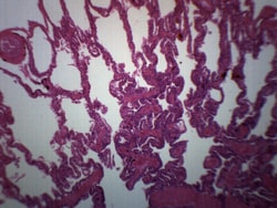 Eisco™ Frog Lung Section