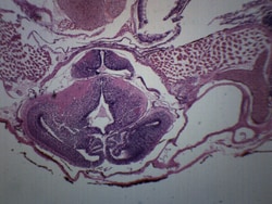 Eisco™ Tadpole Head Region, Cross Section