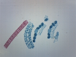 Eisco™ Spirogyra Scalariform Conjugation, Whole Mount