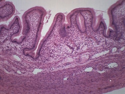 Eisco™ Gallbladder, Cross Section