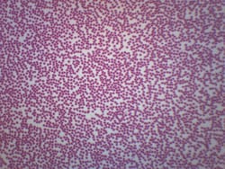 Eisco™ Blood Smear - Fish