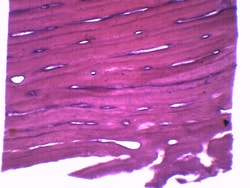 Eisco™ Bone, Cross Section and Longitudinal Section