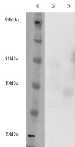 DiscoverX&nbsp;PathHunter&trade; CHO-K1 GPR12 &beta;-Arrestin Orphan GPCR Cell Line