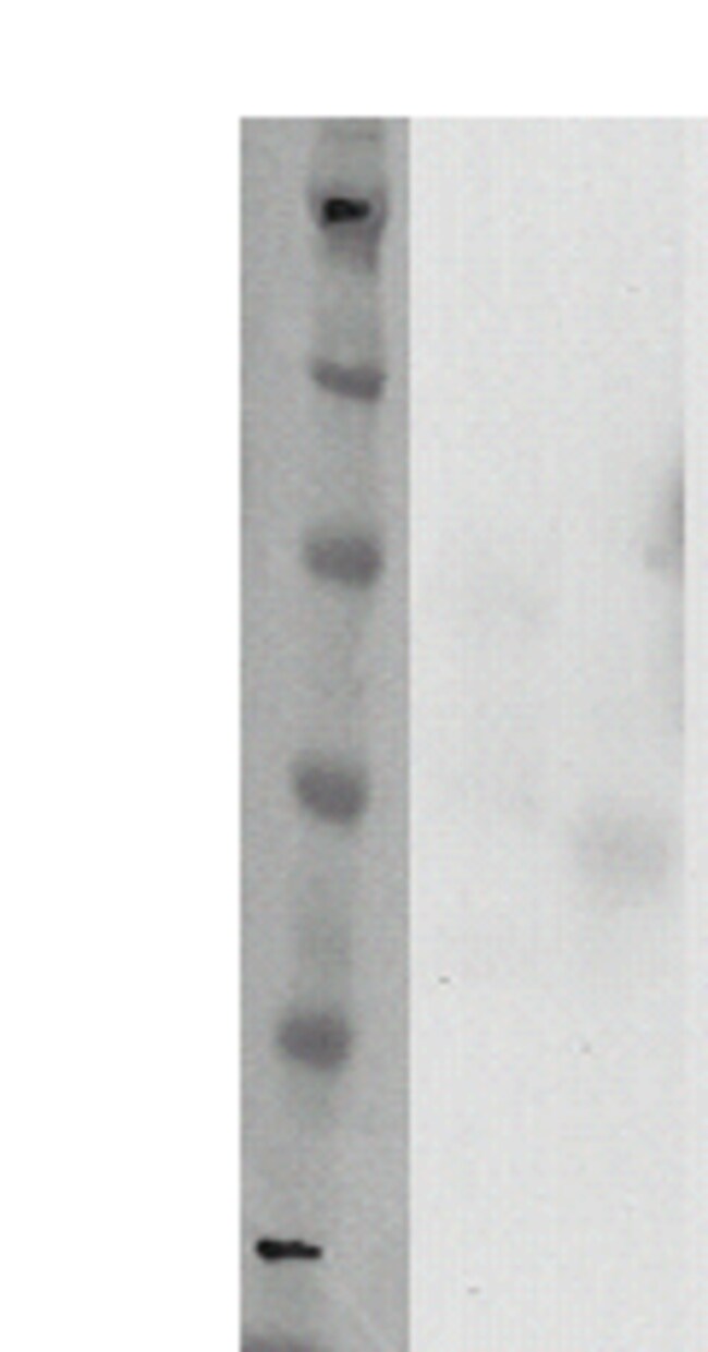 DiscoverX PathHunter eXpress GPR12 CHO-K1 -Arrestin Orphan GPCR Assay 1 ...