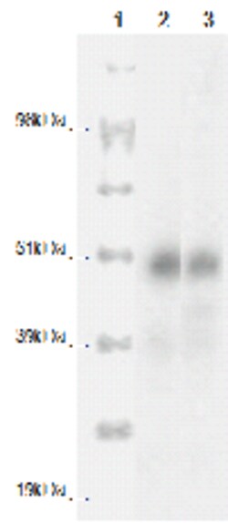 DiscoverX PathHunter eXpress CCRL2 CHO-K1 -Arrestin Orphan GPCR Assay 1 ...