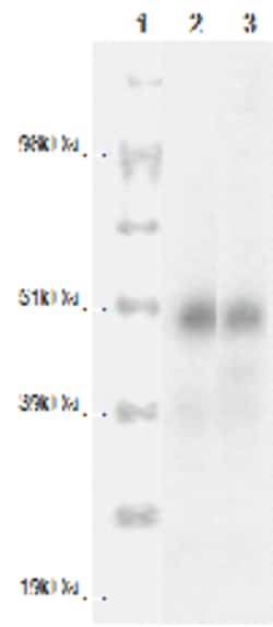 DiscoverX PathHunter eXpress CCRL2 CHO-K1 -Arrestin Orphan GPCR Assay 200 dp (2 x 96-well) | Buy Online | DiscoverX | Fisher Scientific