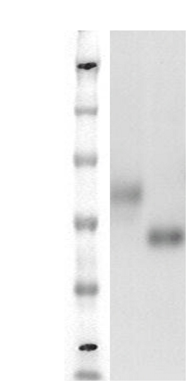 DiscoverX PathHunter eXpress GPR27 CHO-K1 -Arrestin Orphan GPCR Assay 1 ...