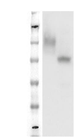 DiscoverX&nbsp;PathHunter&trade; CHO-K1 GPR39 &beta;-Arrestin Orphan GPCR Cell Line