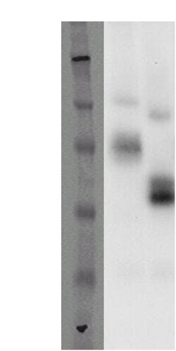 DiscoverX PathHunter eXpress GPR37 CHO-K1 -Arrestin Orphan GPCR Assay 1,000 dp (10 x 96-well) | Buy Online | DiscoverX | Fisher Scientific
