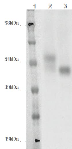 DiscoverX PathHunter CHO-K1 GPR143 -Arrestin Orphan GPCR Cell Line 2 Vials | Buy Online | DiscoverX | Fisher Scientific