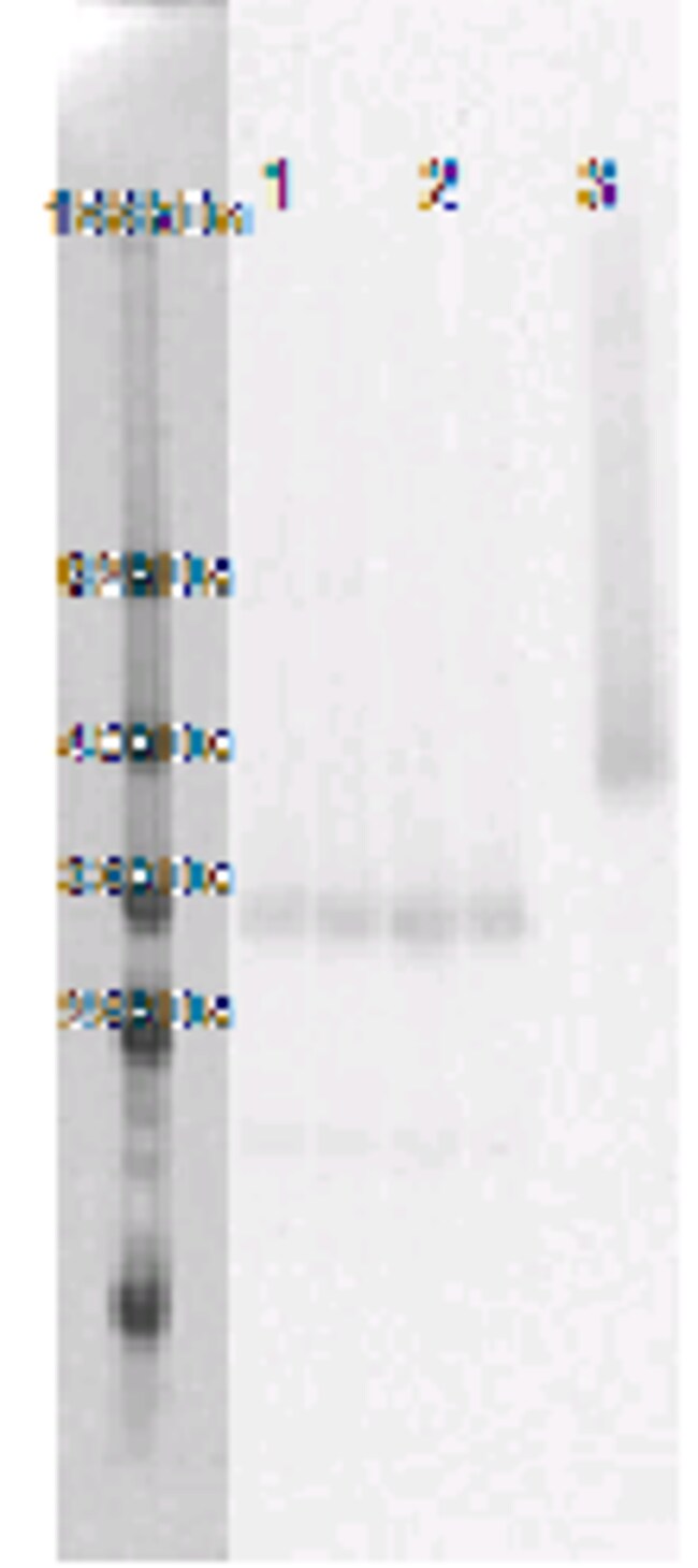 DiscoverX PathHunter eXpress GPR146 CHO-K1 -Arrestin Orphan GPCR Assay ...