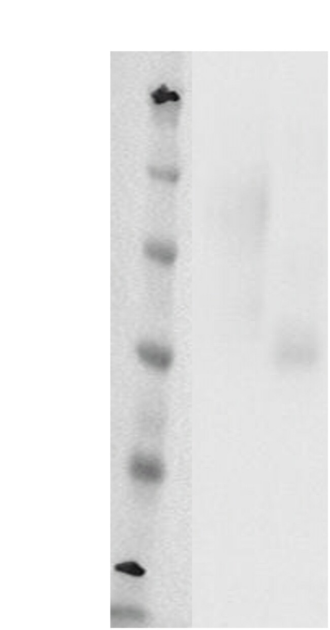 DiscoverX PathHunter eXpress GPR4 CHO-K1 -Arrestin Orphan GPCR Assay ...