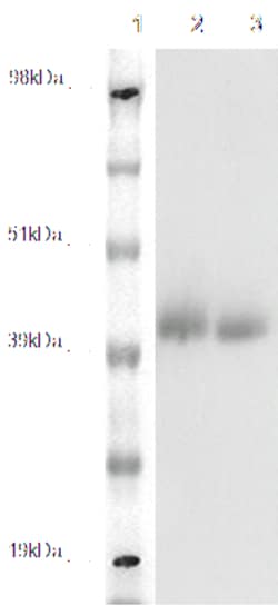 DiscoverX PathHunter eXpress GPR78 CHO-K1 -Arrestin Orphan GPCR Assay 200 dp (2 x 96-well) | Buy Online | DiscoverX | Fisher Scientific