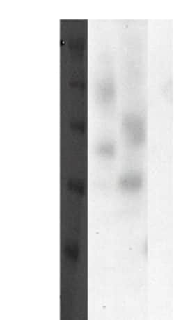 DiscoverX PathHunter eXpress GPR30 CHO-K1 -Arrestin Orphan GPCR Assay 1,000 dp (10 x 96-well) | Buy Online | DiscoverX | Fisher Scientific