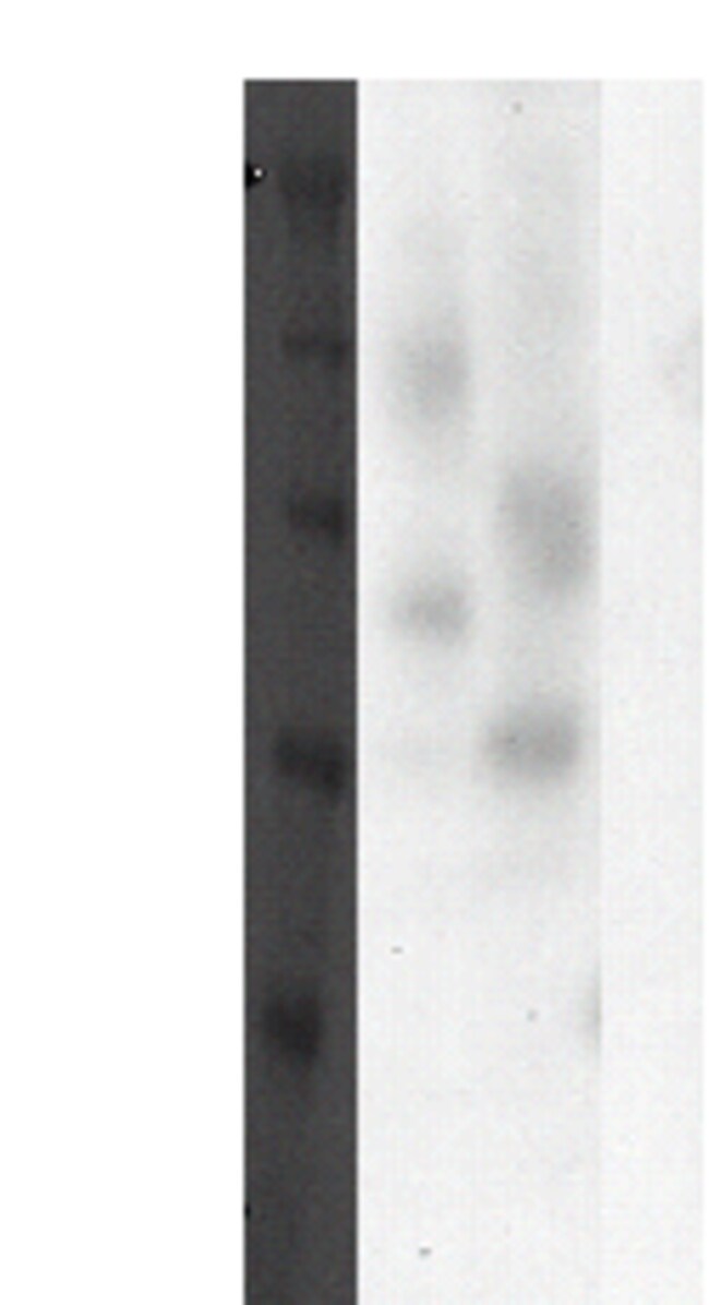 DiscoverX PathHunter eXpress GPR30 CHO-K1 -Arrestin Orphan GPCR Assay 1 ...