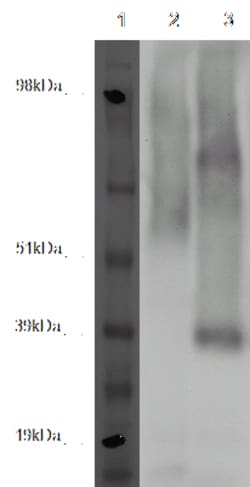 DiscoverX PathHunter eXpress GPR45 CHO-K1 -Arrestin Orphan GPCR Assay 200 dp (2 x 96-well) | Buy Online | DiscoverX | Fisher Scientific