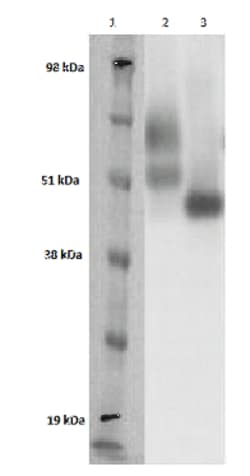 DiscoverX&nbsp;PathHunter&trade; CHO-K1 GPR151 &beta;-Arrestin Orphan GPCR Cell Line