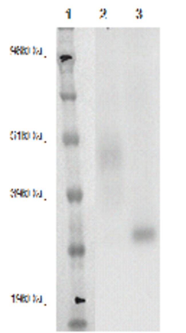 DiscoverX PathHunter eXpress GPR141 CHO-K1 -Arrestin Orphan GPCR Assay ...