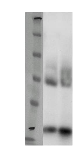 DiscoverX PathHunter eXpress GPR26 CHO-K1 -Arrestin Orphan GPCR Assay 200 dp (2 x 96-well) | Buy Online | DiscoverX | Fisher Scientific