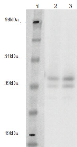 DiscoverX PathHunter CHO-K1 GPR142 -Arrestin Orphan GPCR Cell Line 2 flacons | Buy Online | DiscoverX | Fisher Scientific