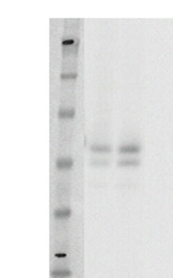DiscoverX PathHunter eXpress GPR142 CHO-K1 -Arrestin Orphan GPCR Assay 1,000 dp (10 x 96-well) | Buy Online | DiscoverX | Fisher Scientific